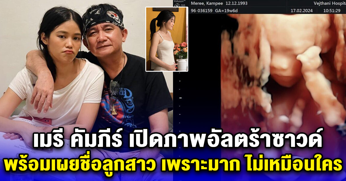 เมรี คัมภีร์ เปิดภาพอัลตร้าซาวด์ พร้อมเผยชื่อลูกสาว เพราะมาก ไม่เหมือนใคร