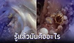 สาวงงเจอวงแหวนฟันสีทองในหนวดปลาหมึก มันคืออะไร ล่าสุดได้คำตอบแล้ว