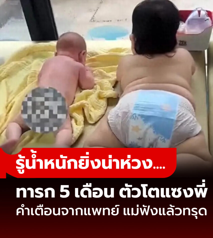รูปสะเทือนใจ ทารกวัย 5 เดือน โตกว่าพี่ชาย “เป็นเท่าตัว!” แม่ช็อก ฟังคำเตือนจากปากแพทย์