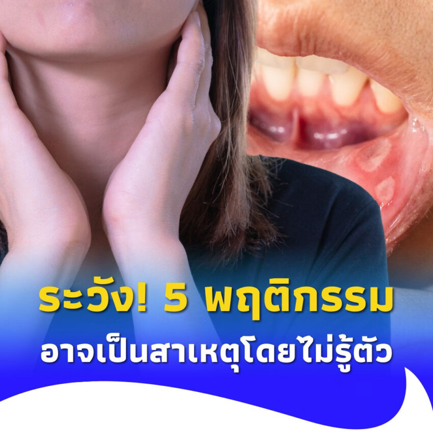 ระวังให้ดี! 5 พฤติกรรมเสี่ยง “อาการร้อนใน” ที่หลายคนมองข้าม
